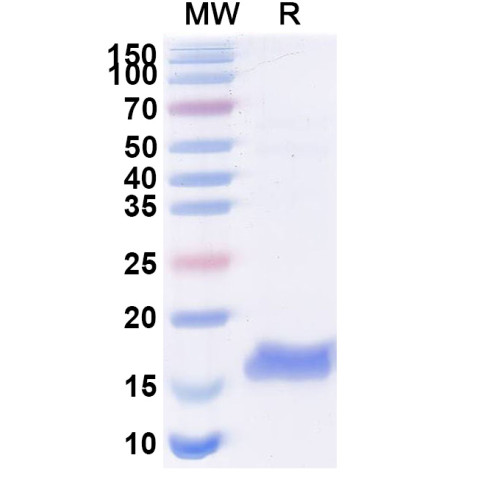 Anti-Human CTNNB1 Nanobody (SAA1188) Anti-Human CTNNB1 Nanobody (SAA1188)
