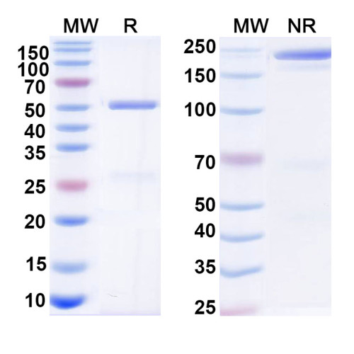 Anti-Human ESR1/ER-alpha Antibody (RB125)