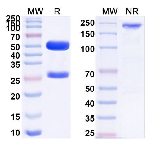 Anti-Human FLNB/Filamin-B Antibody (5H7)