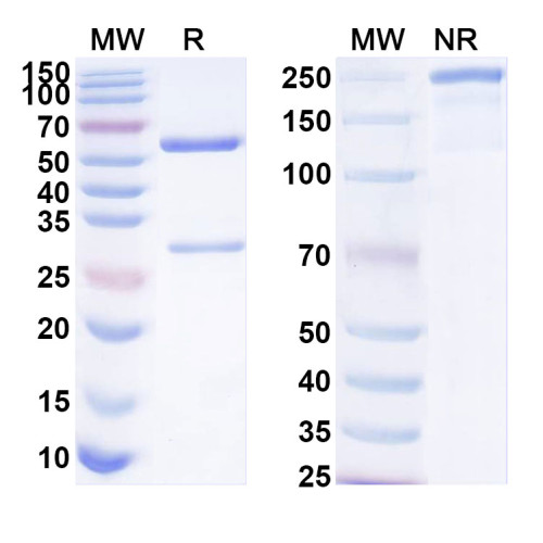 Anti-Human FOLR2/FR-β Antibody (SAA1933)