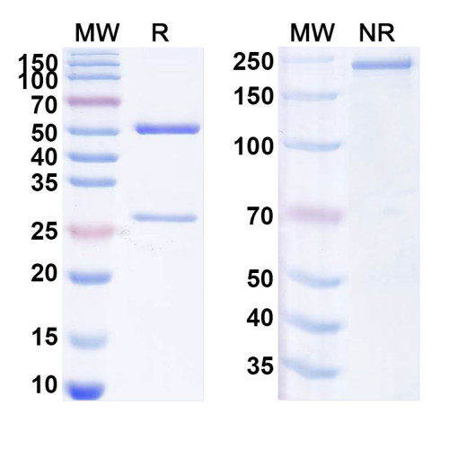 Anti-Human ITGA11/Integrin α11 Antibody (SAA1981) Anti-Human ITGA11/Integrin α11 Antibody (SAA1981)