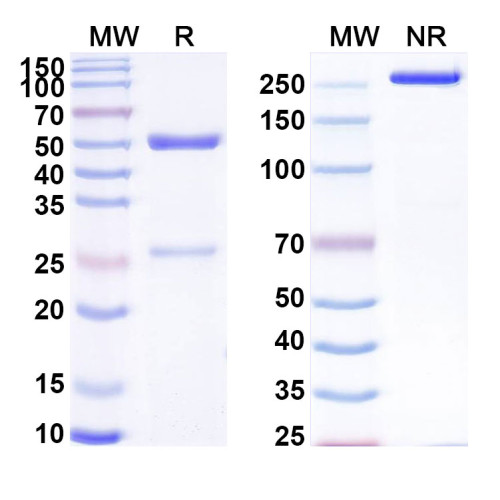 Anti-Human KDM6B IP Antibody (SAA0207) Anti-Human KDM6B IP Antibody (SAA0207)