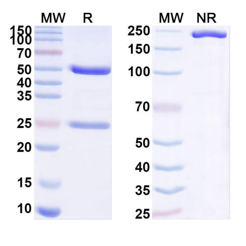 Anti-Human KREMEN2 Antibody (SAA1870)