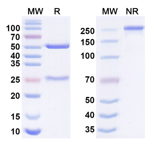 Anti-Human L3MBTL3 IP Antibody (SAA0209) Anti-Human L3MBTL3 IP Antibody (SAA0209)