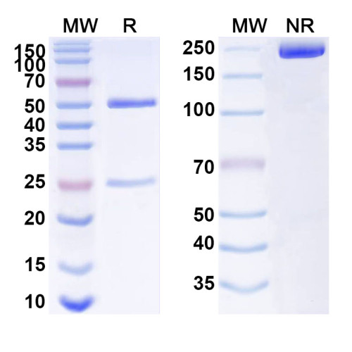 Anti-Human LRP5 Antibody (SAA1526)
