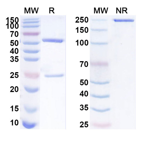 Anti-Human MAGEA6 Antibody (SAA1840)