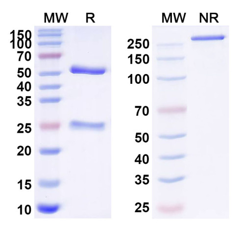 Anti-Human MAP3K2 Antibody (E6#) Anti-Human MAP3K2 Antibody (E6#)