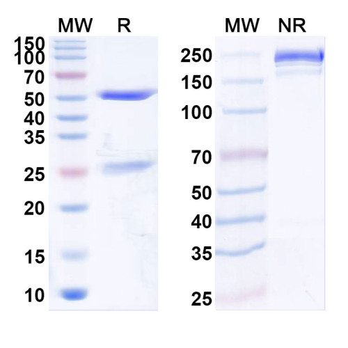 Anti-Human Migration Stimulating Factor (MSF) Antibody (SAA1950)