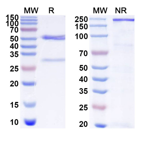 Anti-Human NGLY1 Antibody (SAA1882) Anti-Human NGLY1 Antibody (SAA1882)