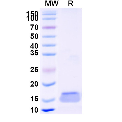 Anti-Human PCSK9 Nanobody (SAA1344) Anti-Human PCSK9 Nanobody (SAA1344)