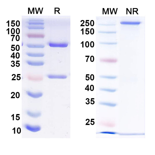 Anti-Human PHF8 IP Antibody (SAA0216) Anti-Human PHF8 IP Antibody (SAA0216)