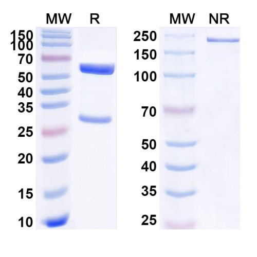 Anti-Human PSEN1/Presenilin-1 Antibody (SAA1782) Anti-Human PSEN1/Presenilin-1 Antibody (SAA1782)