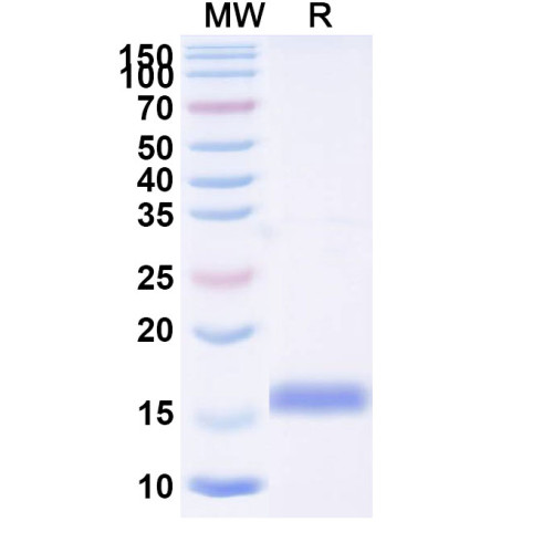 Anti-Human RECQL5 Nanobody (SAA1134)