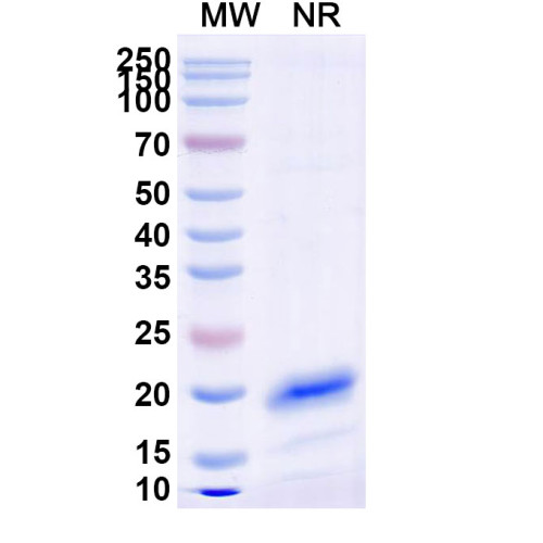 Anti-Human RHOB Nanobody (SAA0880) Anti-Human RHOB Nanobody (SAA0880)