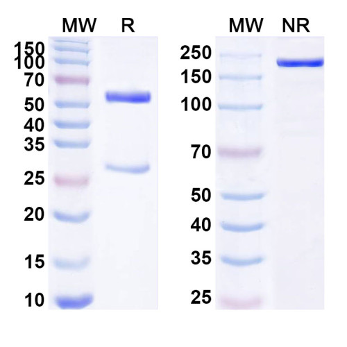 Anti-Human SETD7 IP Antibody (SAA0223) Anti-Human SETD7 IP Antibody (SAA0223)