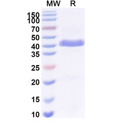 Anti-Human SFTPA Antibody (SAA2226)