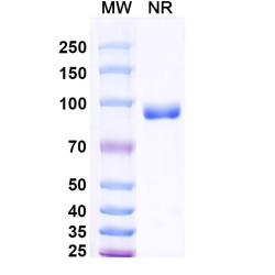 Anti-Human SFTPA Antibody (SAA2227)