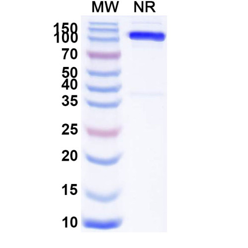 Anti-Human SLC4A7 Antibody (SAA1974)