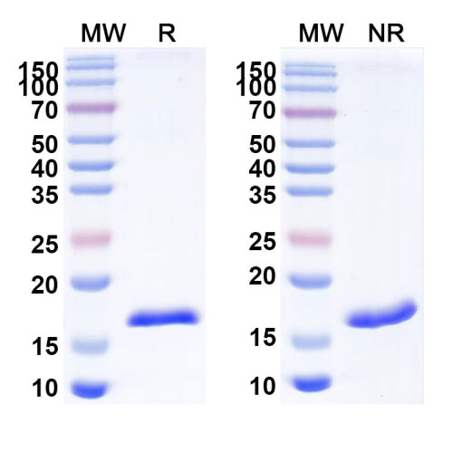 Anti-Human VWF Nanobody (SAA0972)