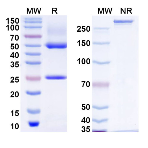 Anti-Human ZFYVE20 Antibody (C18)