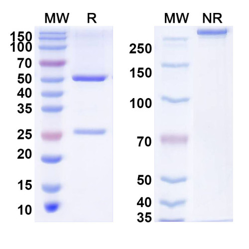 Anti-Human ZHX1 Antibody (C63) Anti-Human ZHX1 Antibody (C63)