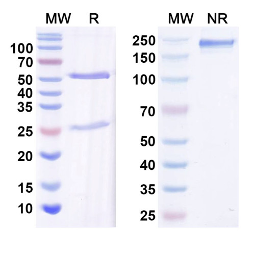 Anti-Kvbeta2 K+ channel Antibody (K17/70)