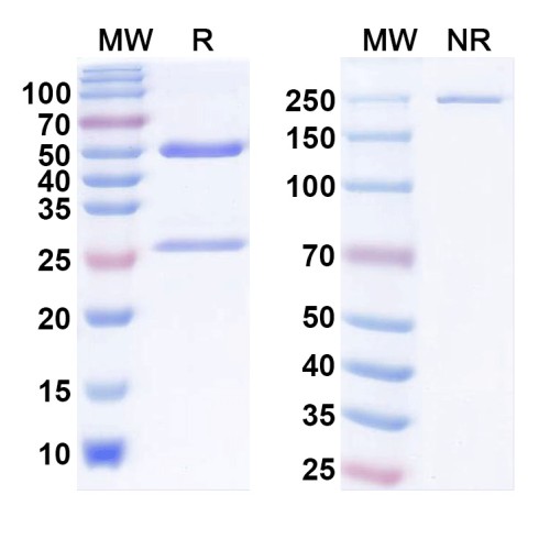 Anti-MARV GP/Envelope glycoprotein Antibody (MR78) Anti-MARV GP/Envelope glycoprotein Antibody (MR78)