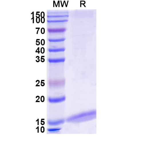 Anti-Mouse Albumin/Alb Nanobody (MSA21) Anti-Mouse Albumin/Alb Nanobody (MSA21)