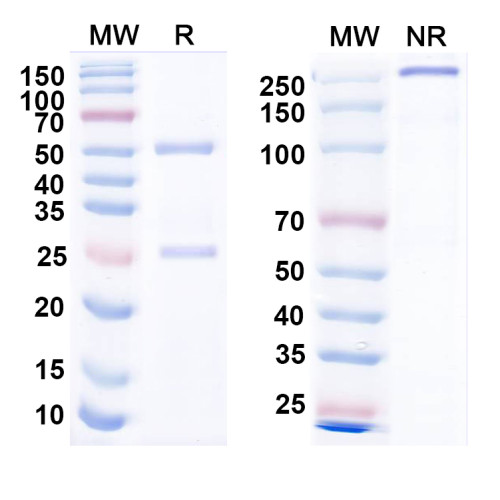 Anti-Notch1 Antibody (N253/27)