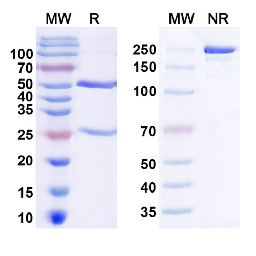 Anti-P2X purinoceptor 2 Antibody (N300/49)