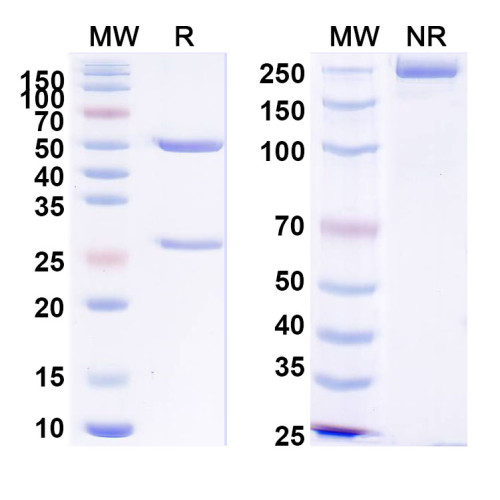 Anti-PHLPV/Allergen Phl p V Antibody (SAA0711) Anti-PHLPV/Allergen Phl p V Antibody (SAA0711)