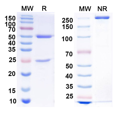 Anti-Parainfluenza virus 5/PIV5 Protein P Antibody (SAA0288)