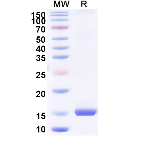 Anti-Porphyromonas gingivalis porM Nanobody (SAA0966)