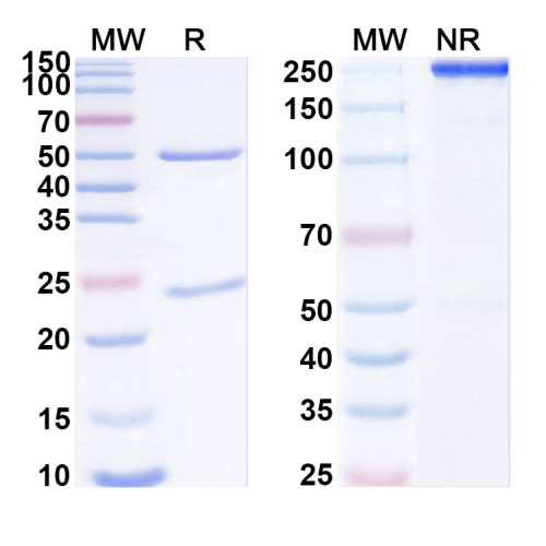 Anti-RSV F/Fusion glycoprotein F0 (SAA2058) Anti-RSV F/Fusion glycoprotein F0 (SAA2058)