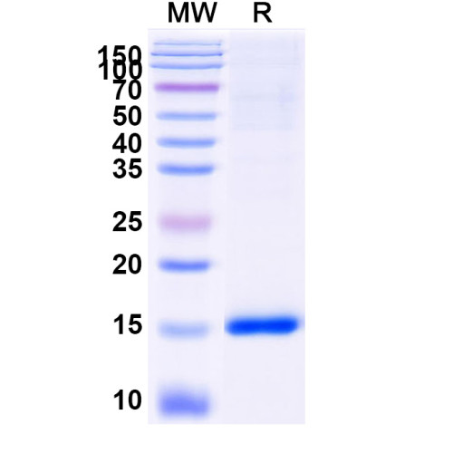 Anti-SARS-CoV-2 S Protein Nanobody (SAA0886) Anti-SARS-CoV-2 S Protein Nanobody (SAA0886)