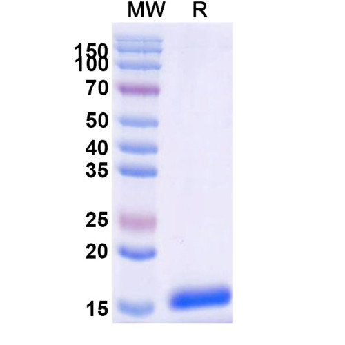 Anti-SARS-CoV-2 S Protein Nanobody (SAA0910) Anti-SARS-CoV-2 S Protein Nanobody (SAA0910)