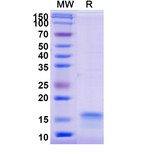 Anti-SARS-CoV-2 S Protein Nanobody (SAA0913) Anti-SARS-CoV-2 S Protein Nanobody (SAA0913)