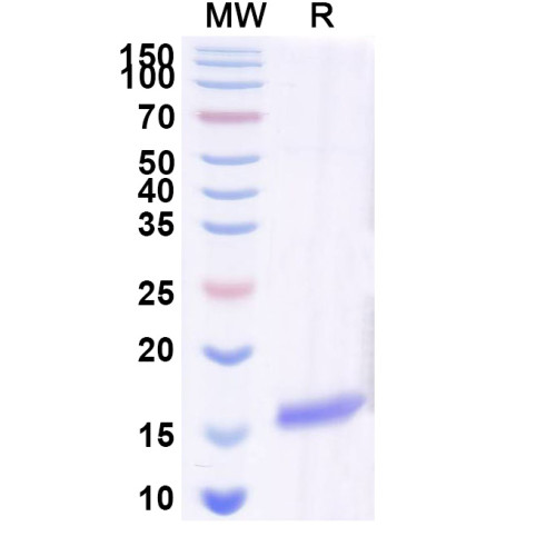 Anti-SARS-CoV-2 S Protein Nanobody (SAA0969) Anti-SARS-CoV-2 S Protein Nanobody (SAA0969)