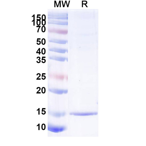 Anti-SARS-CoV-2 S Protein Nanobody (SAA1060) Anti-SARS-CoV-2 S Protein Nanobody (SAA1060)