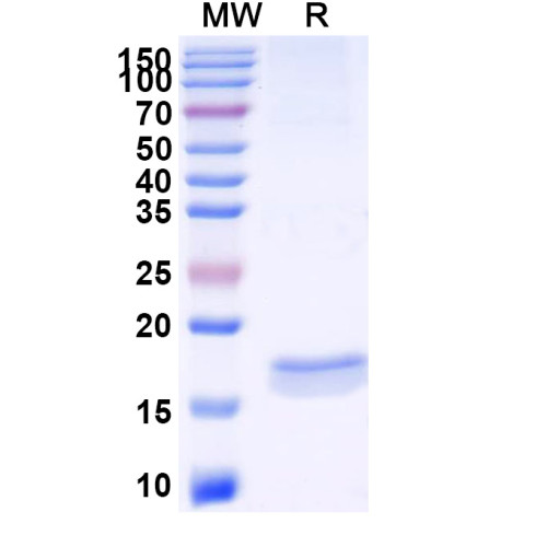 Anti-SARS-CoV-2 S Protein Nanobody (SAA1067)