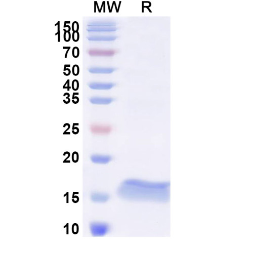 Anti-SARS-CoV-2 S Protein Nanobody (SAA1081) Anti-SARS-CoV-2 S Protein Nanobody (SAA1081)