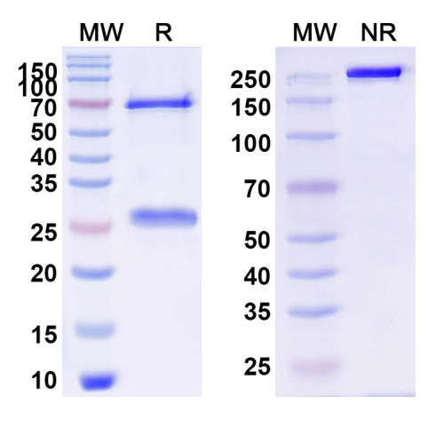 Anti-Schizophyllan/SCH Antibody (JoJ48C11) Anti-Schizophyllan/SCH Antibody (JoJ48C11)