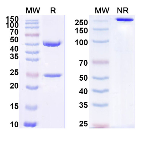Anti-Staphylococcus aureus nuc/Thermonuclease Antibody (SAA1454) Anti-Staphylococcus aureus nuc/Thermonuclease Antibody (SAA1454)