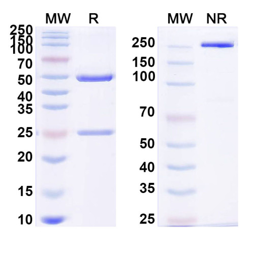 Anti-UBC/polyUb/Polyubiquitin-C Antibody (SAA0328) Anti-UBC/polyUb/Polyubiquitin-C Antibody (SAA0328)