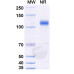 Anti-VSV NP/Nucleoprotein Antibody (1014) Anti-VSV NP/Nucleoprotein Antibody (1014)
