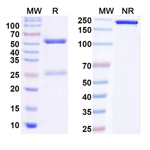 Anti-Vibrio cholerae LPS/Lipopolysaccharide Antibody (SAA0582) Anti-Vibrio cholerae LPS/Lipopolysaccharide Antibody (SAA0582)