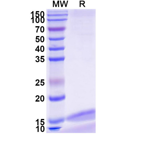 Anti-Zaire ebolavirus/ZEBOV GP/GP1, 2 Nanobody (SAA1248) Anti-Zaire ebolavirus/ZEBOV GP/GP1, 2 Nanobody (SAA1248)