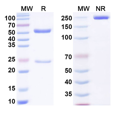 Anti-α-Gal Epitope (Galα1-3Galβ1-4GlcNAc-R) Antibody (P19)