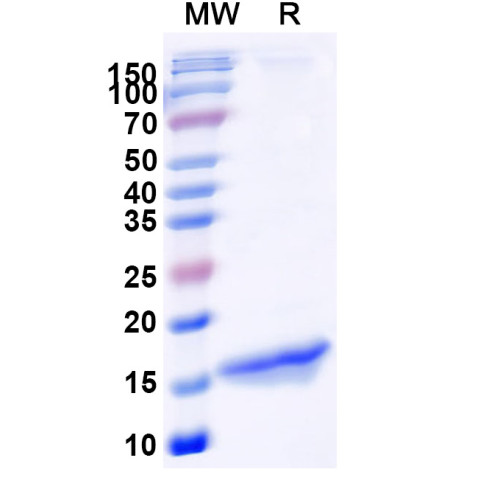 Anti-GFP Nanobody (SAA0975) Anti-GFP Nanobody (SAA0975)