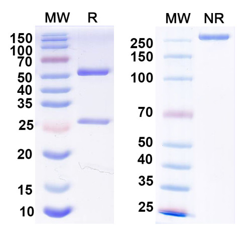 Anti-Human B2M/β2-MG Antibody (1A053) Anti-Human B2M/β2-MG Antibody (1A053)